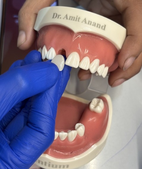 Braces and Aligners