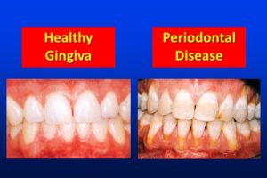 Best Dental Solutions in lucknow