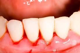 Best Dentist in Gomti Nagar