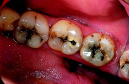 Best dental care in lucknow