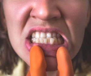 Why Realtooth for Orthodontist