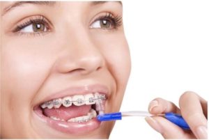 Dental Care in Lucknow