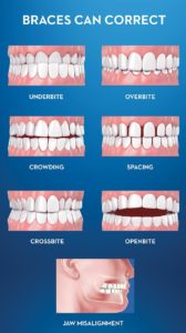 Dental Implants Clinic in Lucknow