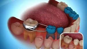 Dental Solution in Lucknow - Realtooth