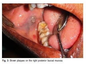 Dentist in Lucknow - realtooth