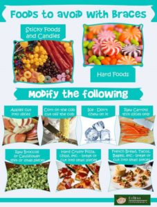 Food Avoid With Braces