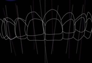 Realtooth -Dental clini In Lucknow, dentist in Lucknow