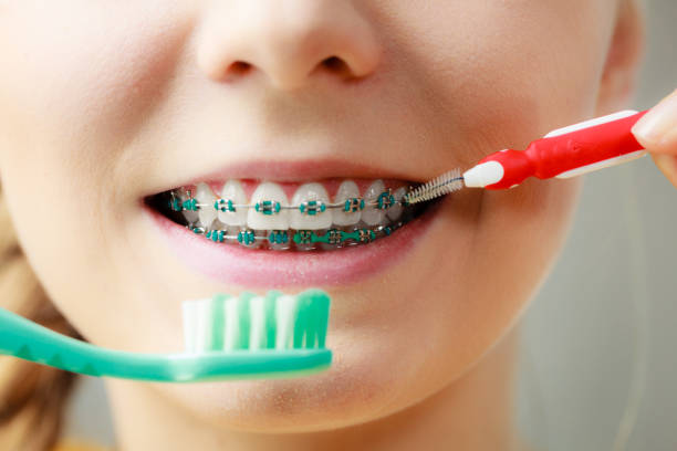 Dental Implant vs Bridge: Which Is Better in 2026?